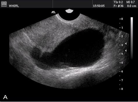 Pin on Ultrasound