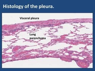 Visceral Pleura Histology