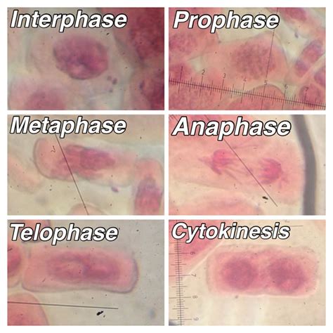 119 best images about School on Pinterest | Streptococcus pneumoniae, Care plans and Cell structure