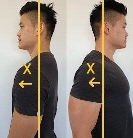 How to Fix Uneven Shoulders - Posture Direct | Shoulder posture, Postures, Posture exercises