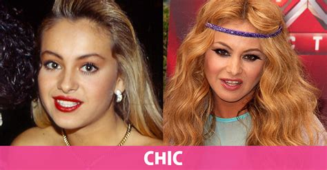 50 famosos, antes y después de la cirugía - Chic