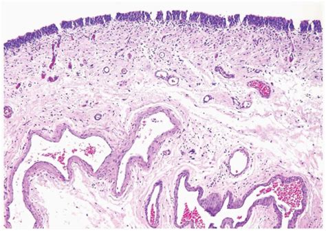 Normal Bladder Anatomy and Variants of Normal Histology | Abdominal Key