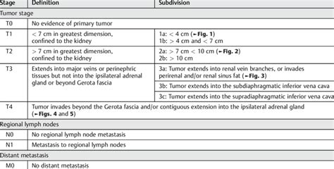 Renal Cell Carcinoma Staging