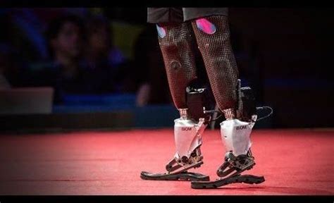 The incredible next generation of bionic limbs and prosthetics