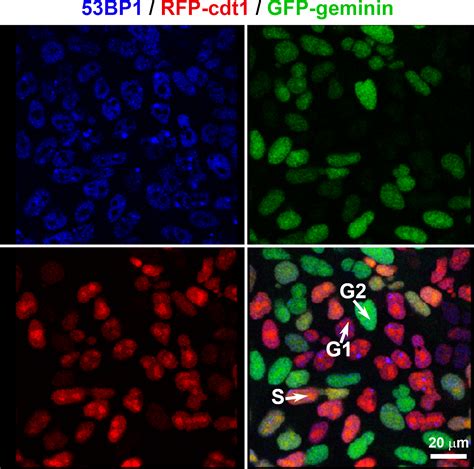 Advanced Confocal Microscopy Techniques to Study Protein-protein ...