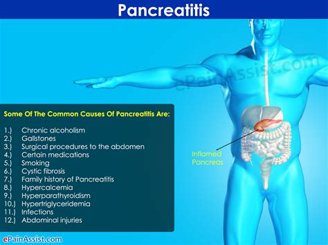 What is Pancreatitis|Treatment|Symptoms|Causes|Diet|Home Remedies