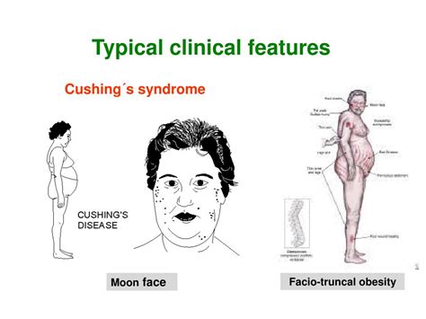 PPT - EXAMINATIONS OF ENDOCRINE DISORDERS Dr. Pavel Maruna PowerPoint Presentation - ID:488204