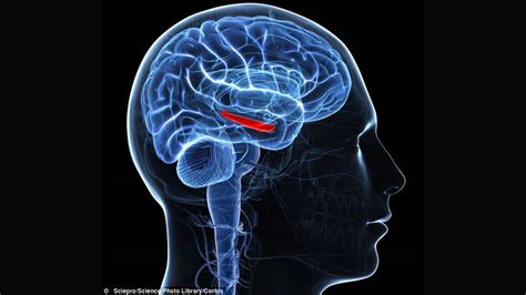 New Brain Implant Technology Can Boost Memory Up To 15 Perce