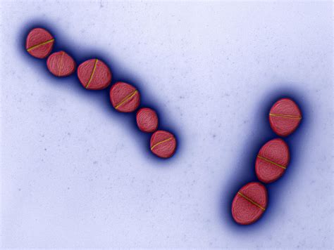 Enterococcus Faecalis 12 0001 Photograph by Eye of Science - Fine Art ...