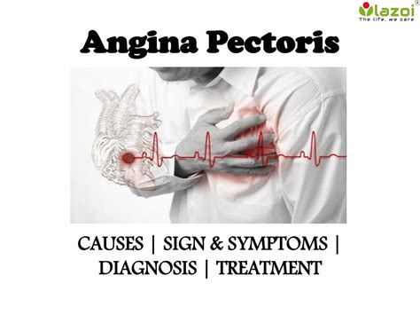 PPT - Angina pectoris : causes, symptoms, diagnosis and treatment ...