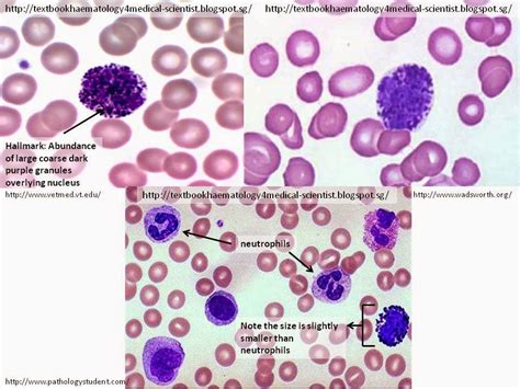 Haematology in a NutShell: Basophils