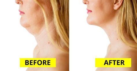 3 Effective Exercises To Lose Your Neck And Face Fat - Fitness Freak