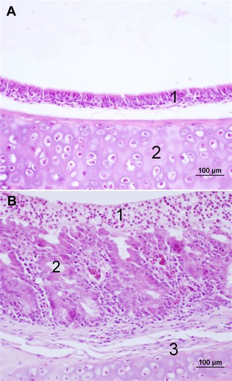 Comparison of normal tracheal tissue and tracheitis with inflammatory... | Download Scientific ...