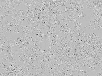 Transfecting Plasmid DNA Into A549 Cells Using Lipofectamine 3000 Reagent | Thermo Fisher ...