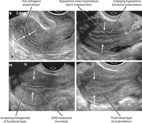 Female Reproductive System | Ultrasound sonography, Medical ultrasound, Ultrasound technician