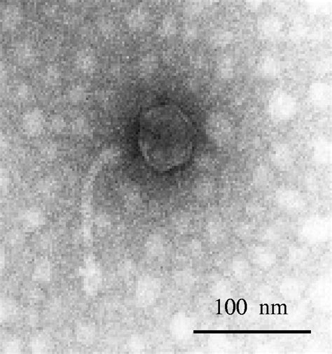 Transmission electron micrograph of phage 1-A4. | Download Scientific Diagram