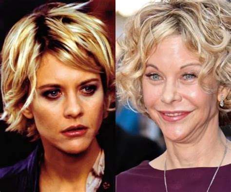 Meg Ryan Plastic Surgery Before and After | Celebie