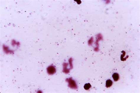 Free picture: thick, film, blood smear, micrograph, numerous, ring, form, plasmodium falciparum ...