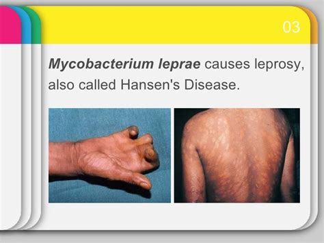Mycobacterium leprae