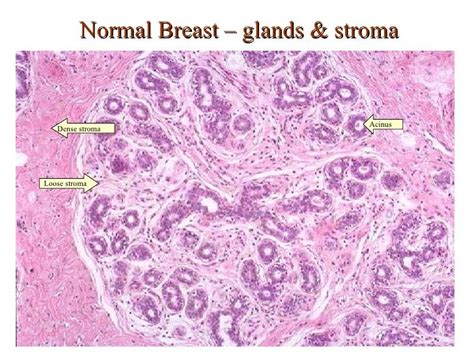 Imagini pentru lobules of breast histology Histology Slides, Medicine ...