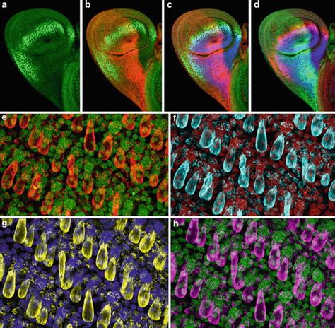 Laser Scanning Confocal Microscopy: History, Applications, and Related ...