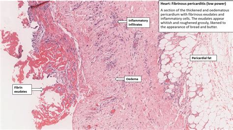 Visceral Pericardium Histology