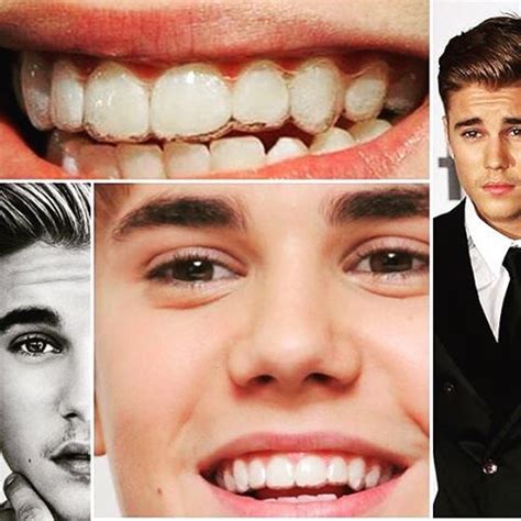 Trident Dentistry on Instagram: “Did you know Justin Bieber chose ...