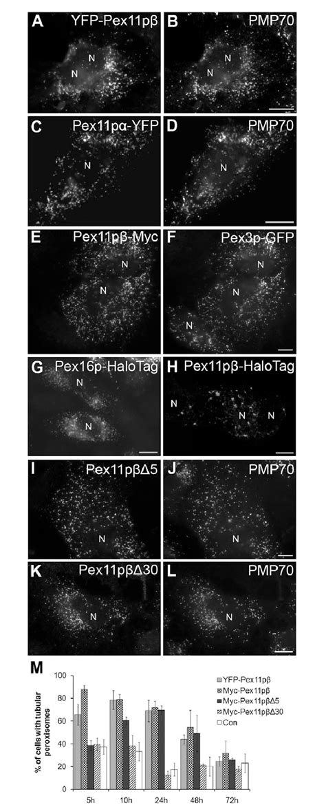 TPA formation depends on Pex11p -YFP. COS-7 cells were transfected with ...