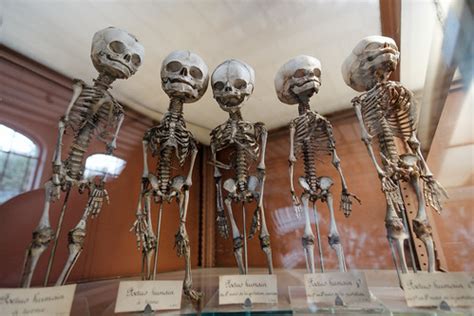 Creepy human fetus skeletons | Galerie de Paléontologie et … | Flickr