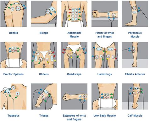 Pin by BodyWorks USA on TENS | Physical therapy, Tens unit placement, Ten unit