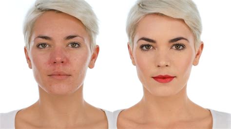 If you have uncomfortable facial redness, you need to see this simple ...