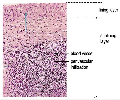 The Amniotic Membrane In The Uterus And Its Histology