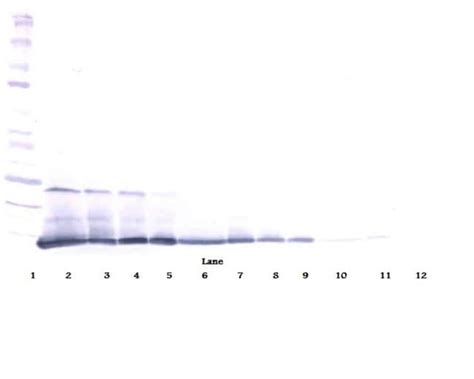 Invitrogen IL-5 Polyclonal Antibody, PeproTech®, Invitrogen™ 100 μg; Unconjugated Products ...