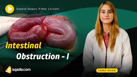 Intestinal Obstruction | General Surgery | Online Medical Education Videos | V-Learning™ - YouTube