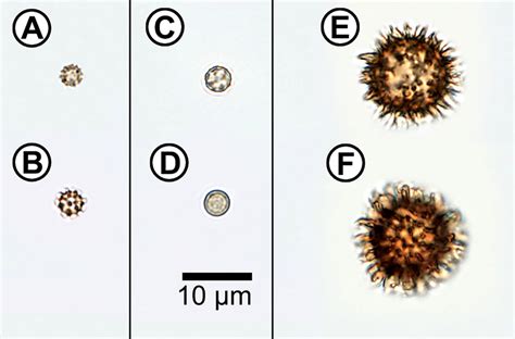 Microscope image of fungal spores. (A) Geastrum fimbriatum; (B)... | Download Scientific Diagram