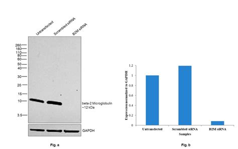 beta-2 Microglobulin Antibody (PA5-29580)