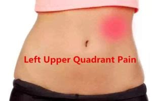 Left Upper Quadrant Pain: 12 Causes with Treatments