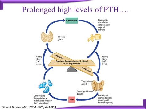 Role of Teriparatide in Severe Osteoporosis