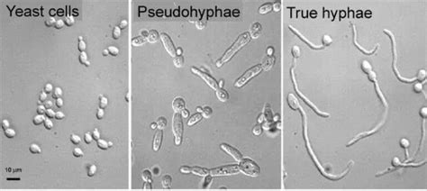 Observing Yeast Under The Microscope » Microscope Club