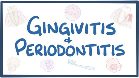 Gingivitis and periodontitis - causes, symptoms, diagnosis, treatment, pathology - YouTube