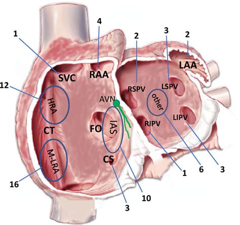 Right Atrium Location Anatomy Function Human