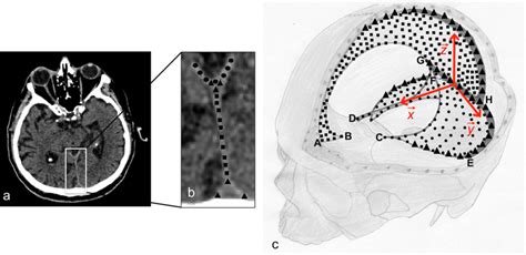 Pointing acquisition from CT scan. (a) Example of an axial CT scan... | Download Scientific Diagram