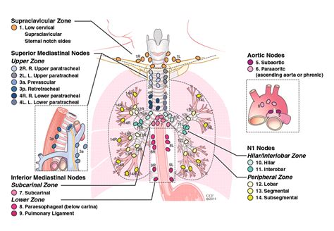 Mediastinal Lymph Node Staging: From Noninvasive to Surgical | AJR