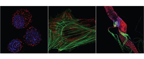 Confocal Based Imaging | National Institute of Dental and Craniofacial ...