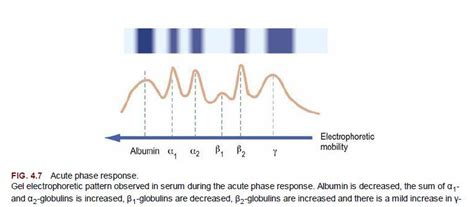 The Acute Phase Response | Medical Laboratories