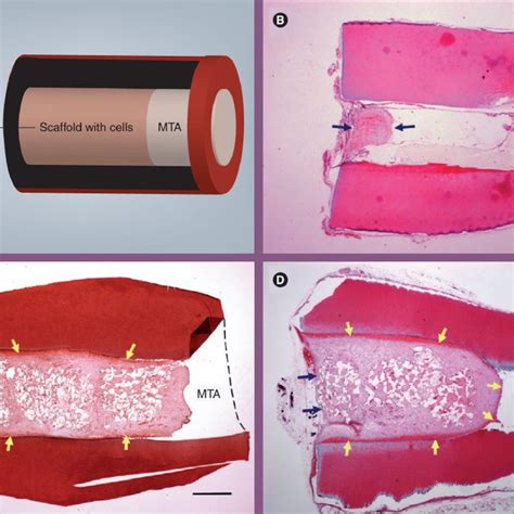 Root fragment In vivo model for pulp/dentin regeneration | Download Scientific Diagram