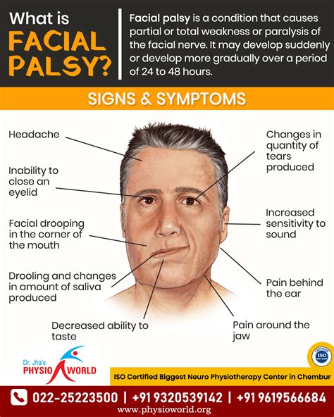 Facial Palsy Signs & Symptoms | Facial nerve, Facial palsy treatment, Muscles of the face