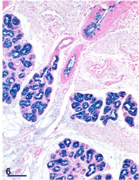 Photomicrograph of the tubal tonsil showing presence of acidic ...