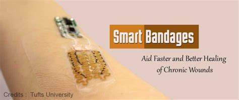 Revolutionary Smart Bandage with Biosensors Monitors Wounds and Heals Faster: A Game-Changer in ...