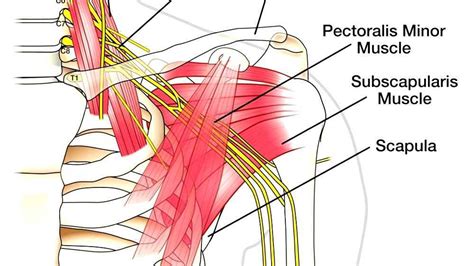 Brachial plexus injury